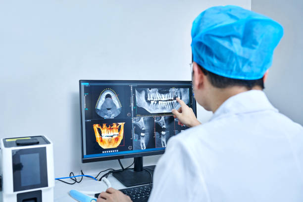 Best Emergency Tooth Extraction in Port Washington, WI